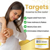 1+1 FREE | BuzzAway™ Instantly Relieves Itching And Discomfort