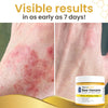 1+1 FREE | BuzzAway™ Instantly Relieves Itching And Discomfort