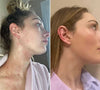 1+1 FREE | BuzzAway™ Instantly Relieves Itching And Discomfort