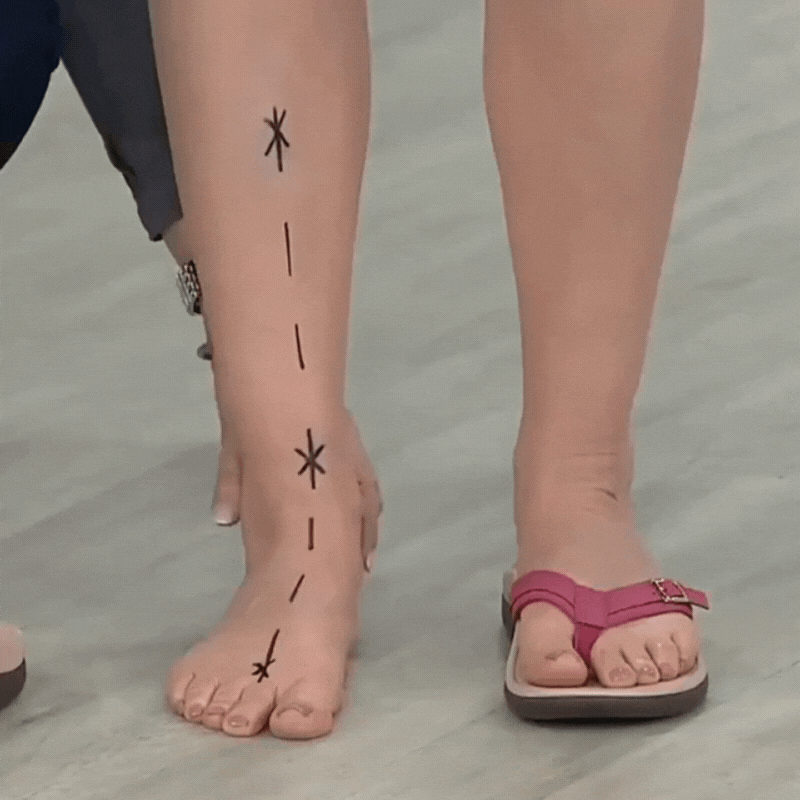 ZenStep™ - Orthopedic Summer Shoes