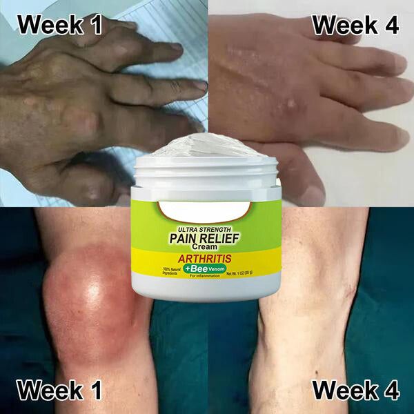 1+1 FREE | Pain Relief Gel™ Say goodbye to persistent joint pain!