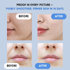 1+1 FREE | YouthLift Renew Strips™ Combat Fine Lines and Sagging Skin in Minutes