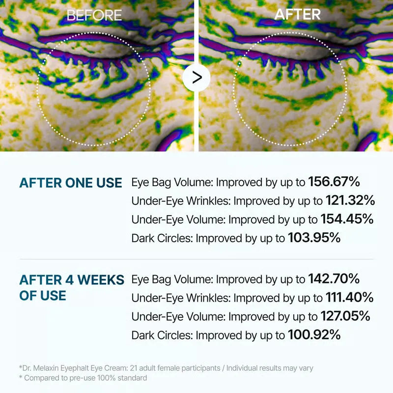 1+1 FREE | FirmEye™ Refreshes Tired Eyes Reveals a Youthful Glow