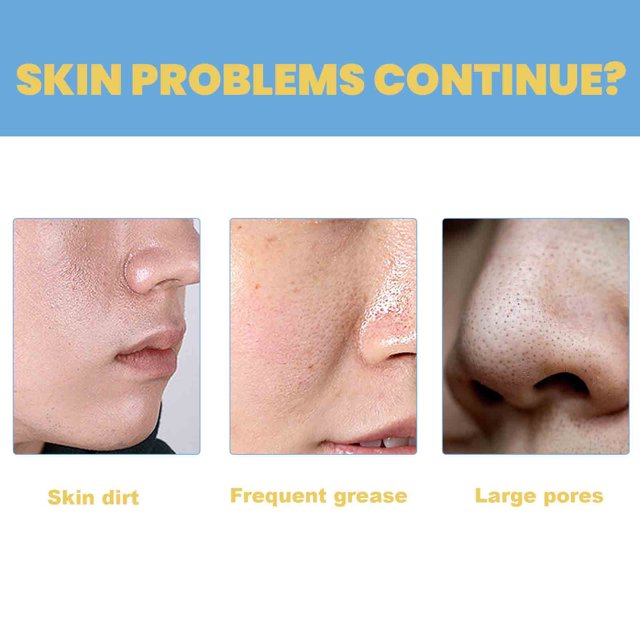 5+5 Free | DeepPurify™ Clarifying Serum — Dissolves Blackheads for Smooth, Radiant Skin