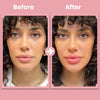 VoluFleur™ Lip Roller – Natural full lips that shine confidently, completely painless