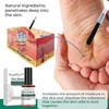 1+1 Free | FootPro™ - Corn Removal Extra Strength Gel