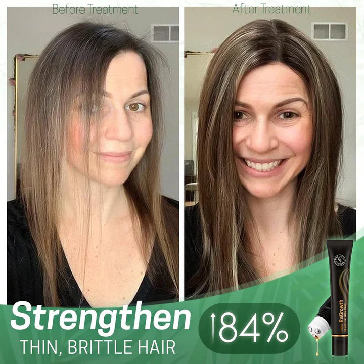 1+1 FREE | NextGrow™ Stop Hair Loss and Stimulate Growth Naturally