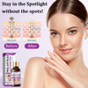 1+1 Free | Ceoerty™ MelantraX Advanced Anti-Hyperpigmentation Essence — Reveal radiant, flawless skin you'll love