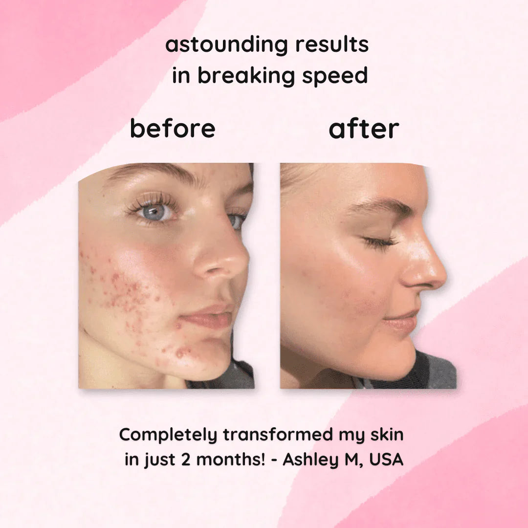 2+2 FREE | BrightEase™ – Unveil radiant, even skin that turns heads