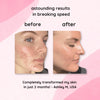 2+2 FREE | BrightEase™ – Unveil radiant, even skin that turns heads