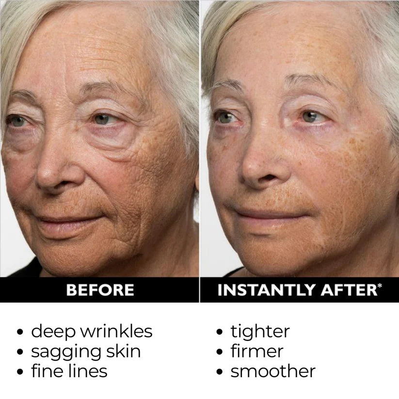 1+1 FREE | Instant Temporary Skin Tightener™  Reveal Smooth, Youthful Skin in Minutes