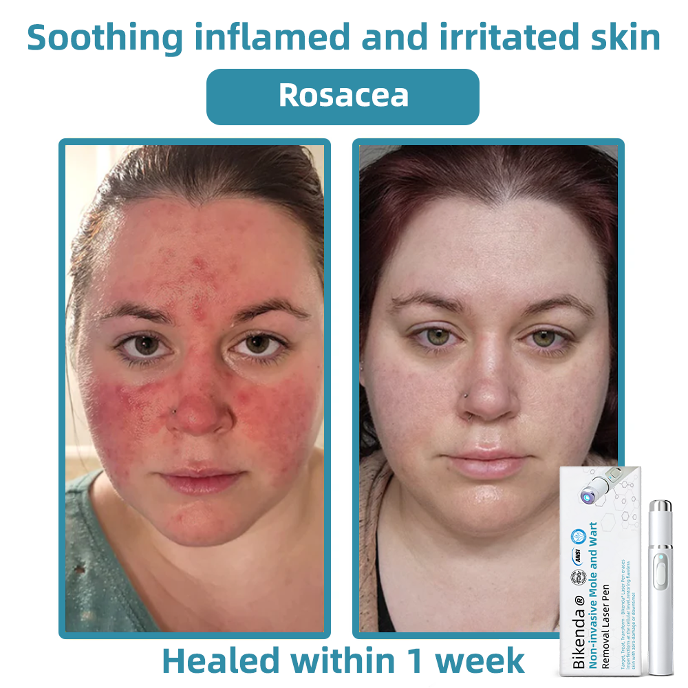 LumiDerm™ – Reveal Radiant, Flawless Skin and Achieve Quick Confidence
