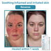 LumiDerm™ – Reveal Radiant, Flawless Skin and Achieve Quick Confidence