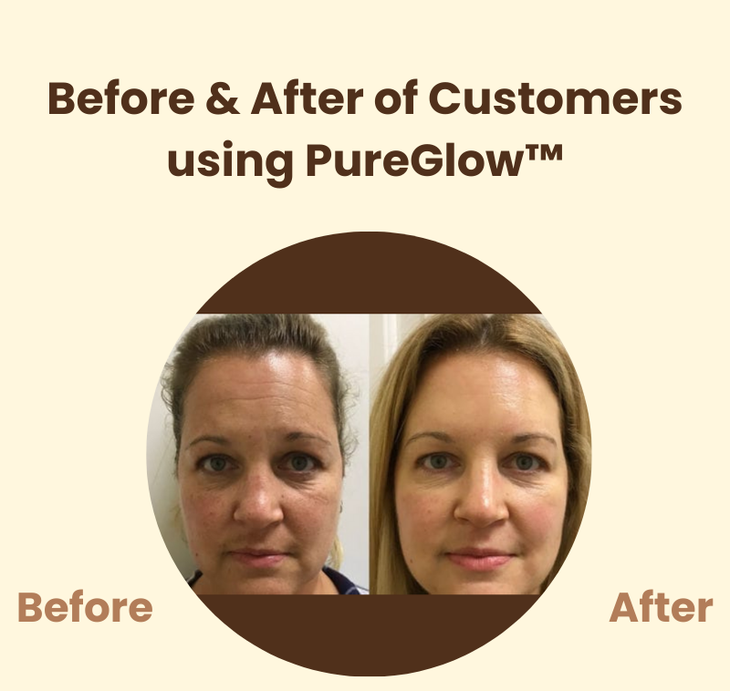 PureGlow™ – Radiant Skin