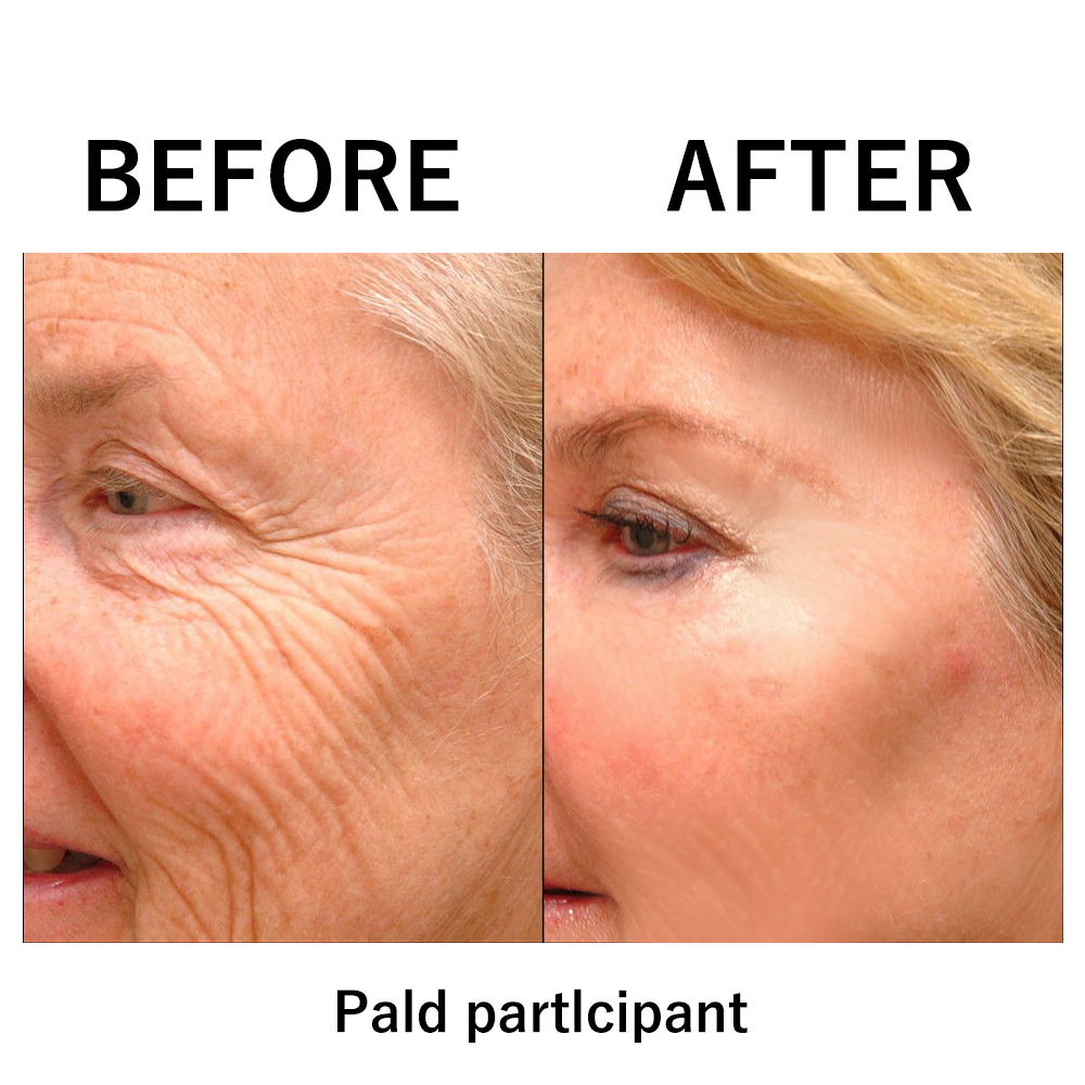 1+1 FREE | Instant Temporary Skin Tightener™  Reveal Smooth, Youthful Skin in Minutes