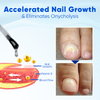 1+1 FREE | Biancat™ OnyxoGuard Nail Growth and Repair Serum — Revitalizes and strengthens nails quickly for healthier, more beautiful nails