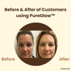 1+1 Free | PureGlow Black Tea Mask™ – Clear, youthful skin that exudes confidence