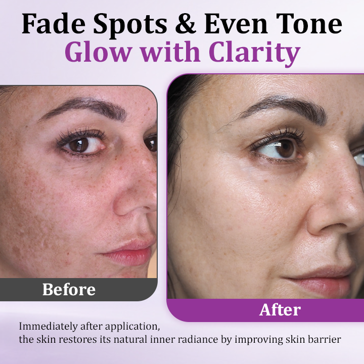 1+1 Free | Ceoerty™ MelantraX Advanced Anti-Hyperpigmentation Essence — Reveal radiant, flawless skin you'll love