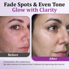 1+1 Free | Ceoerty™ MelantraX Advanced Anti-Hyperpigmentation Essence — Reveal radiant, flawless skin you'll love