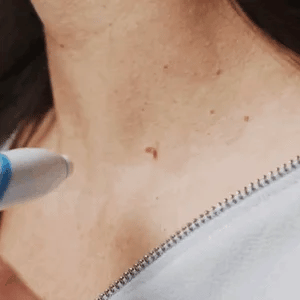 TagGone™ - Fast Auto Tag Removal Kit