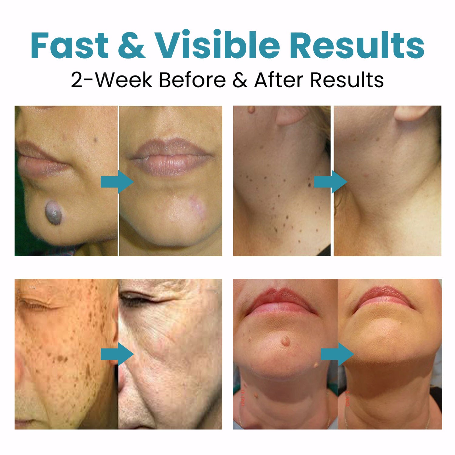 LumaClear™ — Reveals flawless, radiant skin you'll love to show off
