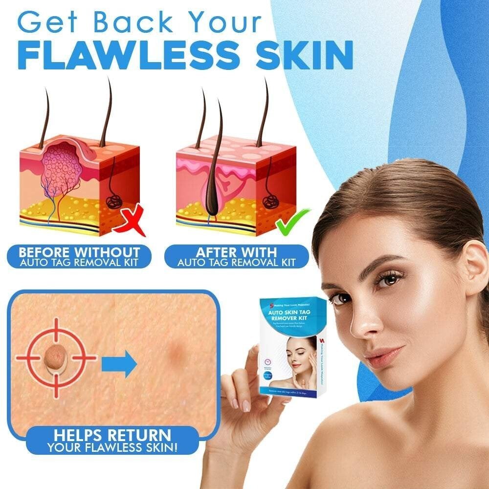 TagGone™ - Fast Auto Tag Removal Kit
