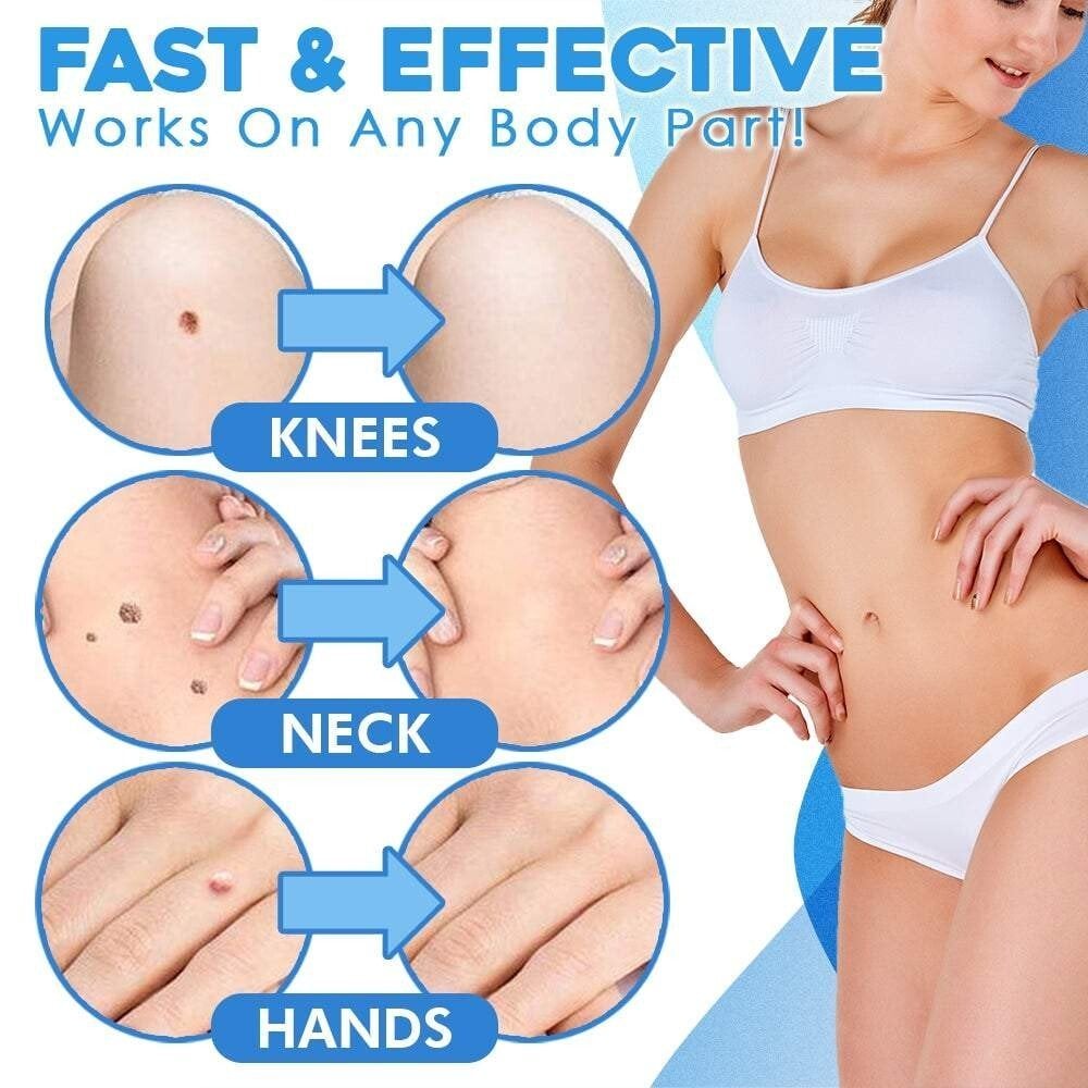 TagGone™ - Fast Auto Tag Removal Kit