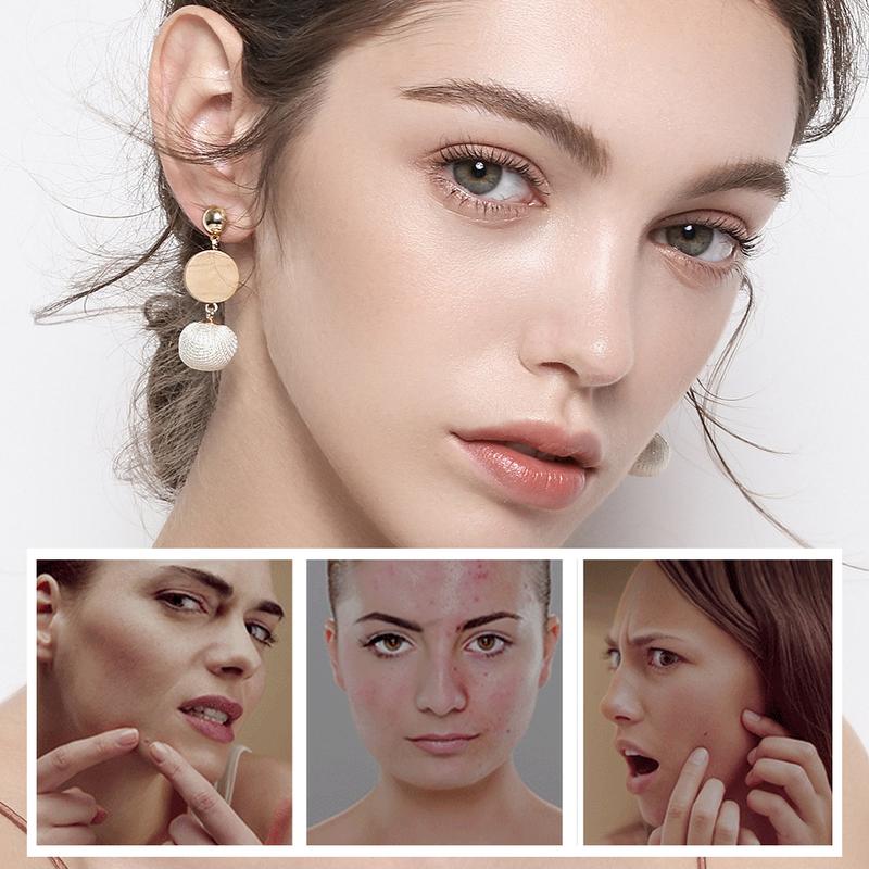 GlowTallow™ - Beef Tallow Beeswax and Honey Face Moisturizer - Handmade 100% Natural Moisturizer