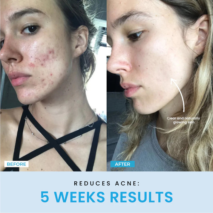 ContourVive™ – Tighten and Define Your Jawline for Timeless Confidence