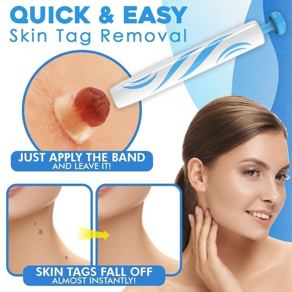TagGone™ - Fast Auto Tag Removal Kit