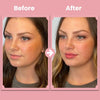 VoluFleur™ Lip Roller – Natural full lips that shine confidently, completely painless