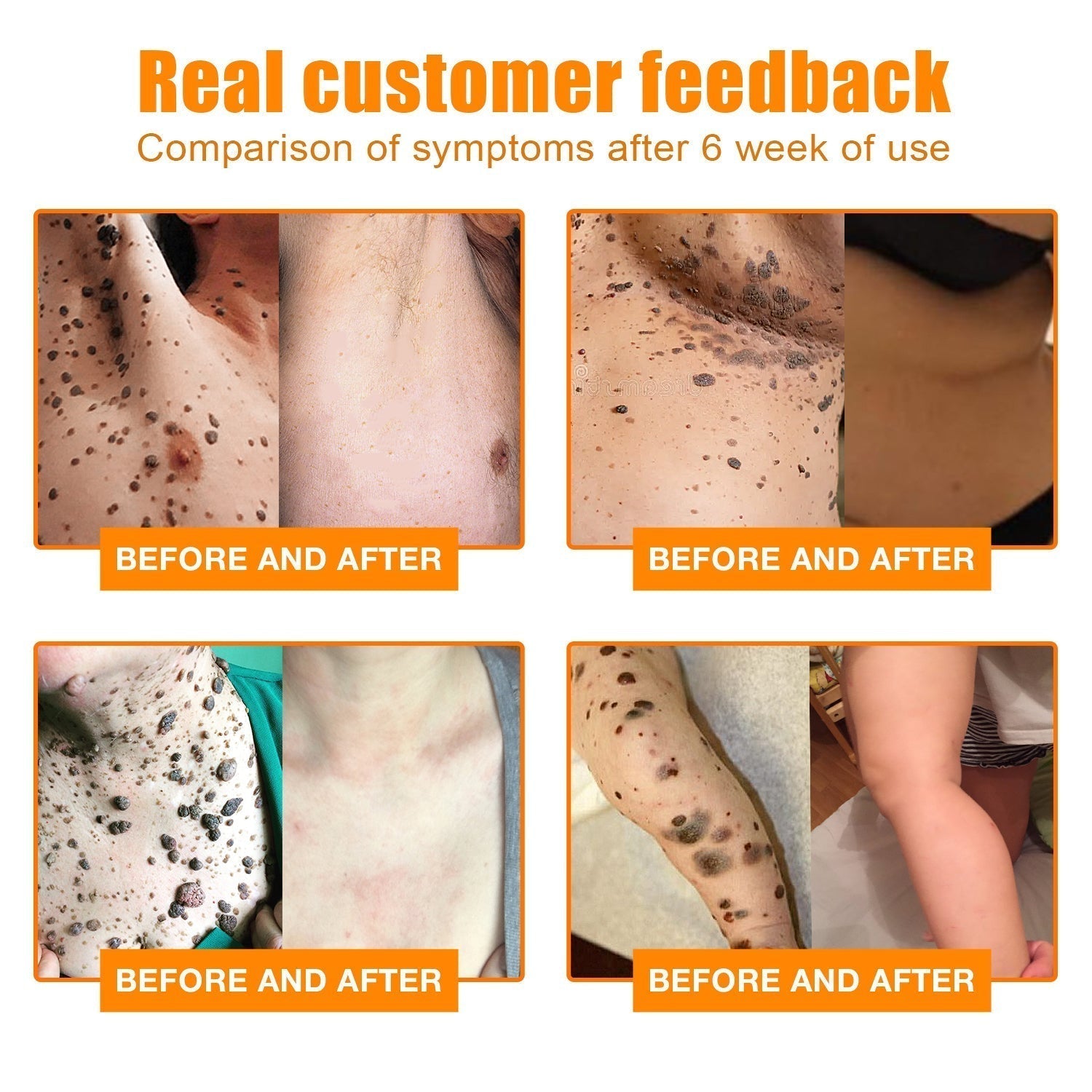 1+1 Free | NEWYOU™ TagLift Neck Gift Treatment — Painless Skin Renewal for Clear, Confident Skin