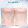 Springle™ - Anti-wrinkle massager for face and neck
