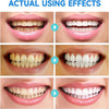 PureTeeth™ - Niacinamide Whitening Toothpaste