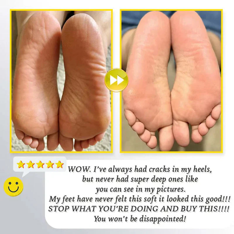Gleam™ - Gentle Corn Removal for Soft, Smooth Feet