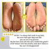 Gleam™ - Gentle Corn Removal for Soft, Smooth Feet