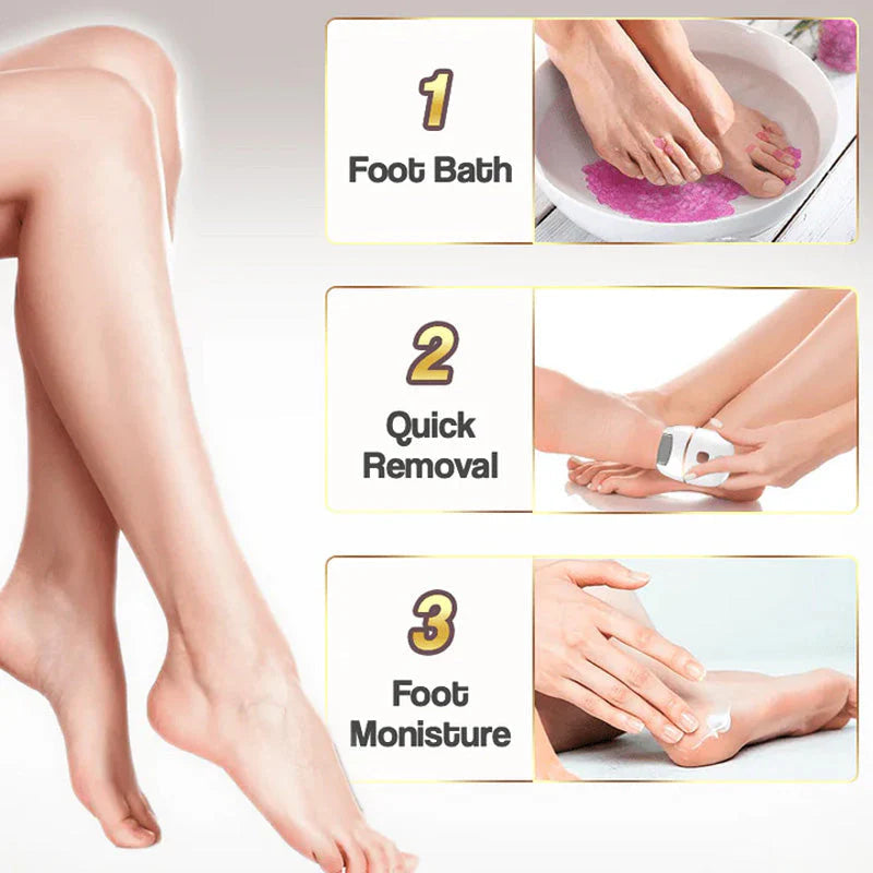 Gleam™ - Gentle Corn Removal for Soft, Smooth Feet