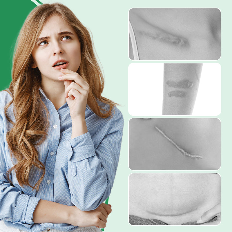1+1 Free | Scarify™ - Reusable Silicone Scar Patch