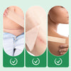 1+1 Free | Scarify™ - Reusable Silicone Scar Patch