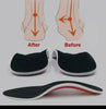 1+1 FREE | ArchEase™ - Orthopedic Insoles